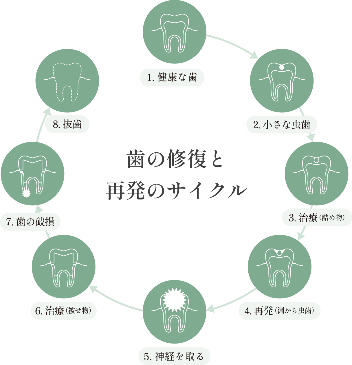 歯の修復と再発のサイクル